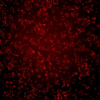 Mouse pancreatic cancer cell line XPA1.The corresponding FOV is 1.7 x 1.7mm. Further magnification to 8.8x reveals more detail of the tissue, cell orientation, areas of high RFP concentration, and cytoplasmic morphology.  Side lighting was used to illuminate the sample with 4 sec. exposure.